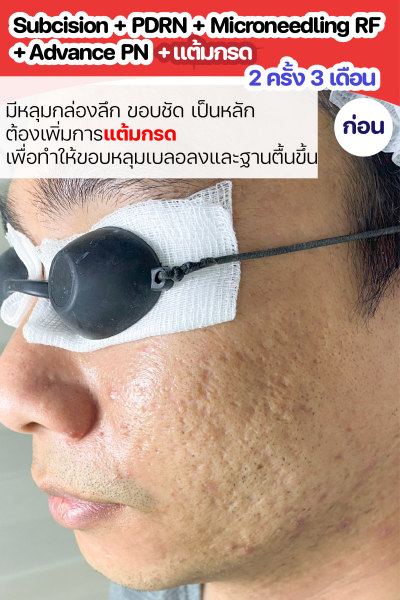 ขนาดเว็บ-01