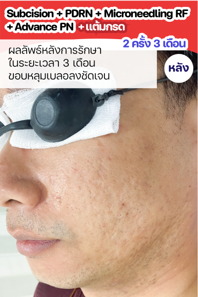 ขนาดเว็บ-02