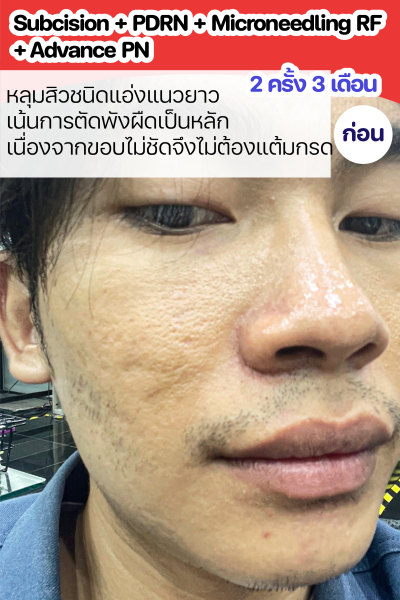 ขนาดเว็บ-03