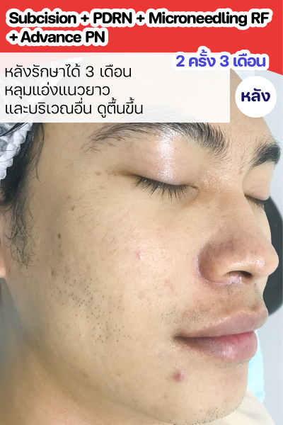 ขนาดเว็บ-04
